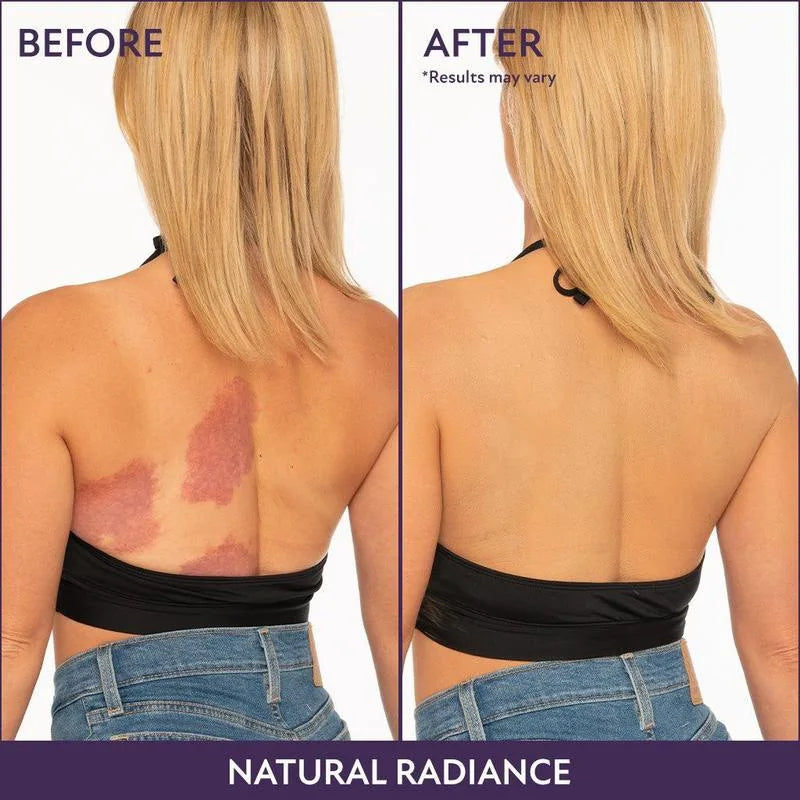 Body Coverage Perfector+ Buffer Brush - Flawless Body Makeup, Concealer for Scars, Spots, Veins, Tattoos and More Blend Cosmetic