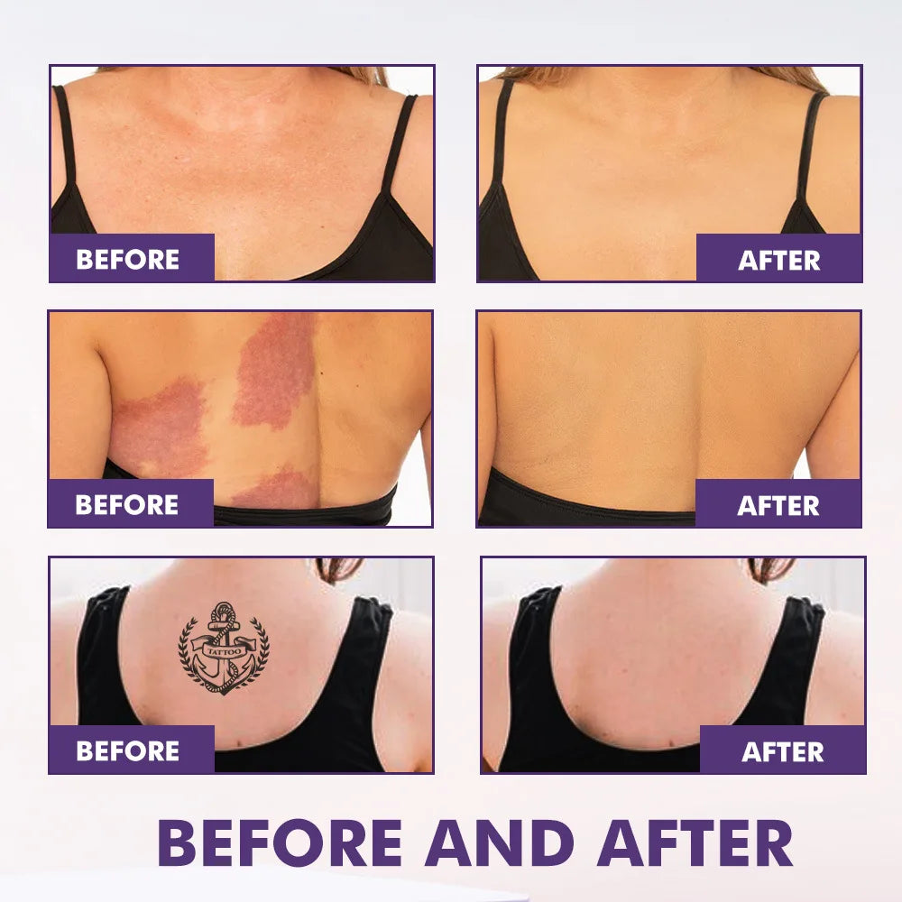 Body Coverage Perfector+ Buffer Brush - Flawless Body Makeup, Concealer for Scars, Spots, Veins, Tattoos and More Blend Cosmetic