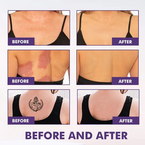 Body Coverage Perfector+ Buffer Brush - Flawless Body Makeup, Concealer for Scars, Spots, Veins, Tattoos and More Blend Cosmetic